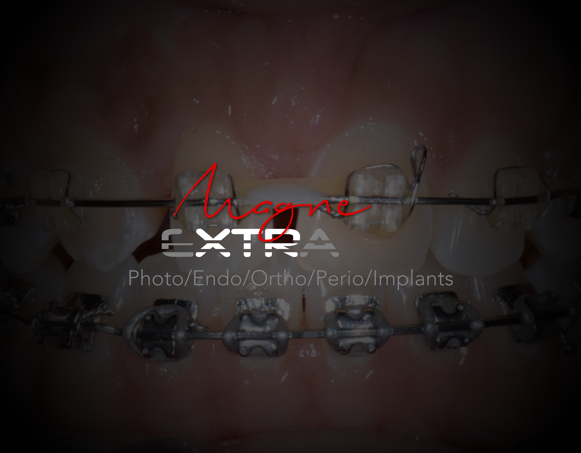 Orthodontic Course for Restorative Dentists (Feb 28 – March 1, 2025)